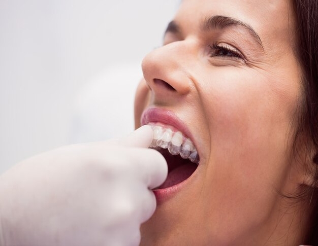 Ağız ve Diş Estetiğinde Çarpık Diş Tedavisi Dentapolitan İstanbul